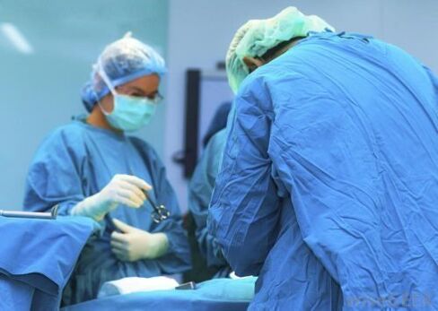 chirurginis papilomos pašalinimas